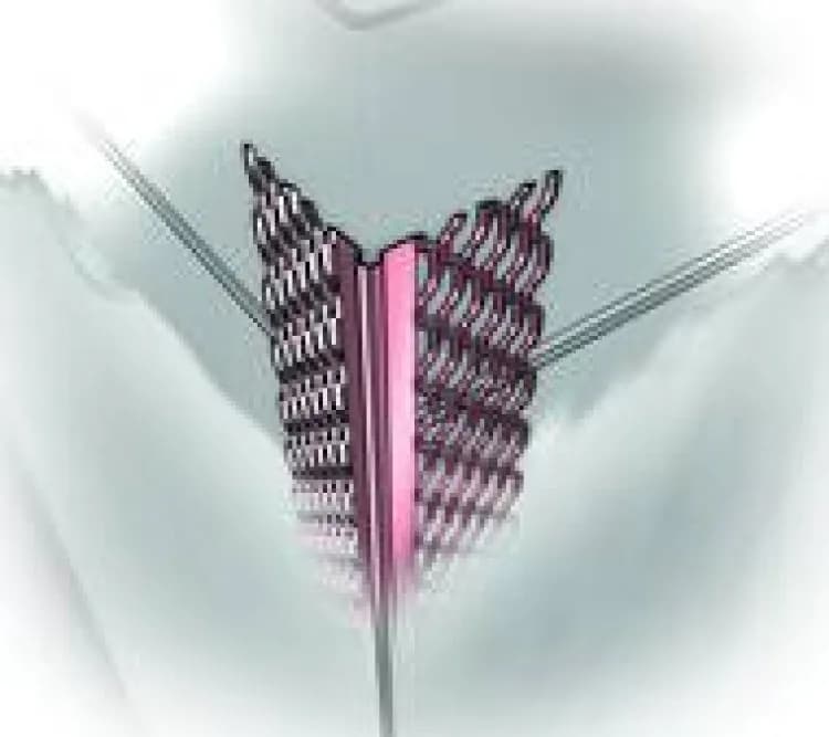 Jakie narożniki do tynków gipsowych wybrać, by uniknąć problemów?